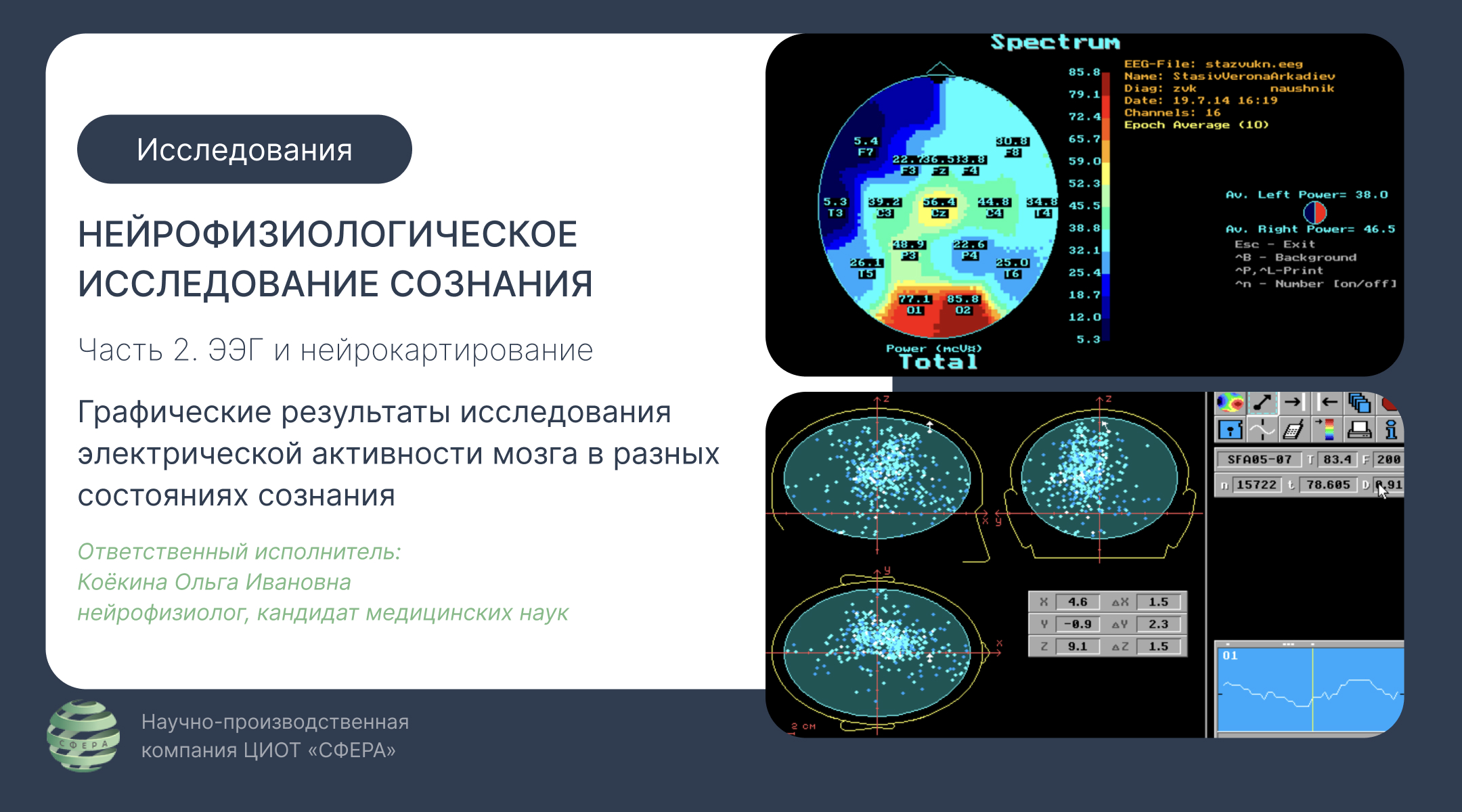 ЭЭГ и нейрокартирование мозга — часть 2 нейрофизиологического исследования сознания