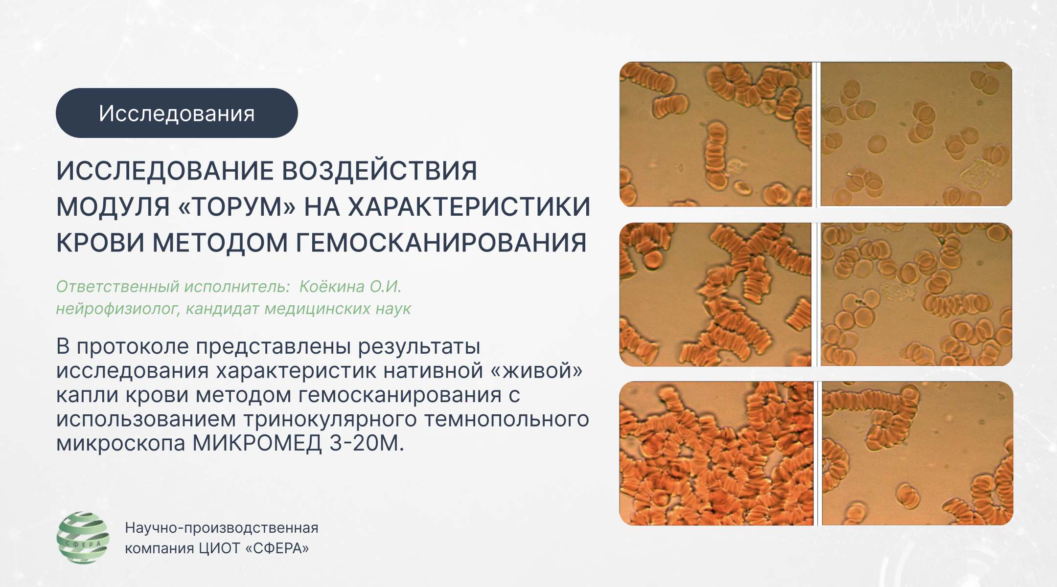 Исследование модуля «ТОРУМ» на диагностическом комплексе «ЛОТОС-ОНИКС»